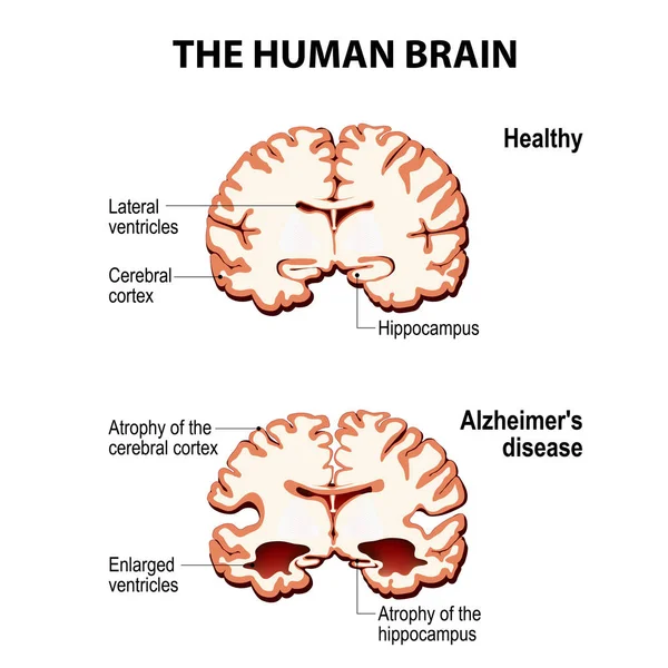 Людський мозок . — стоковий вектор