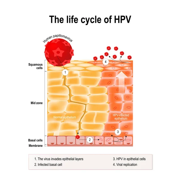 Lebenszyklus von hpv im menschlichen Epithel. — Stockvektor