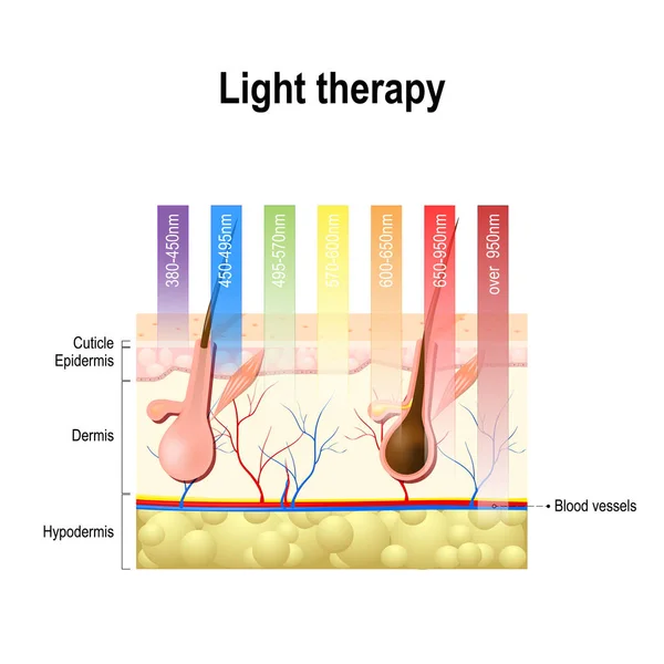 Terapia della luce, fototerapia o terapia laser . — Vettoriale Stock