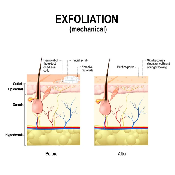 Exfoliering eller Peeling är ett kosmetiskt ingrepp — Stock vektor