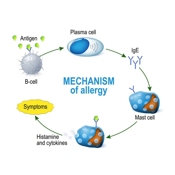 Mechanism of allergy. Mast cells and allergic reaction — Stock Vector