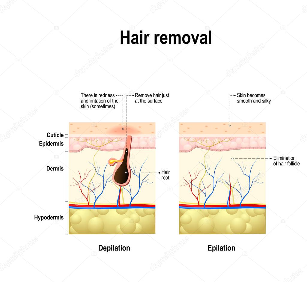 epilation and depilation difference.