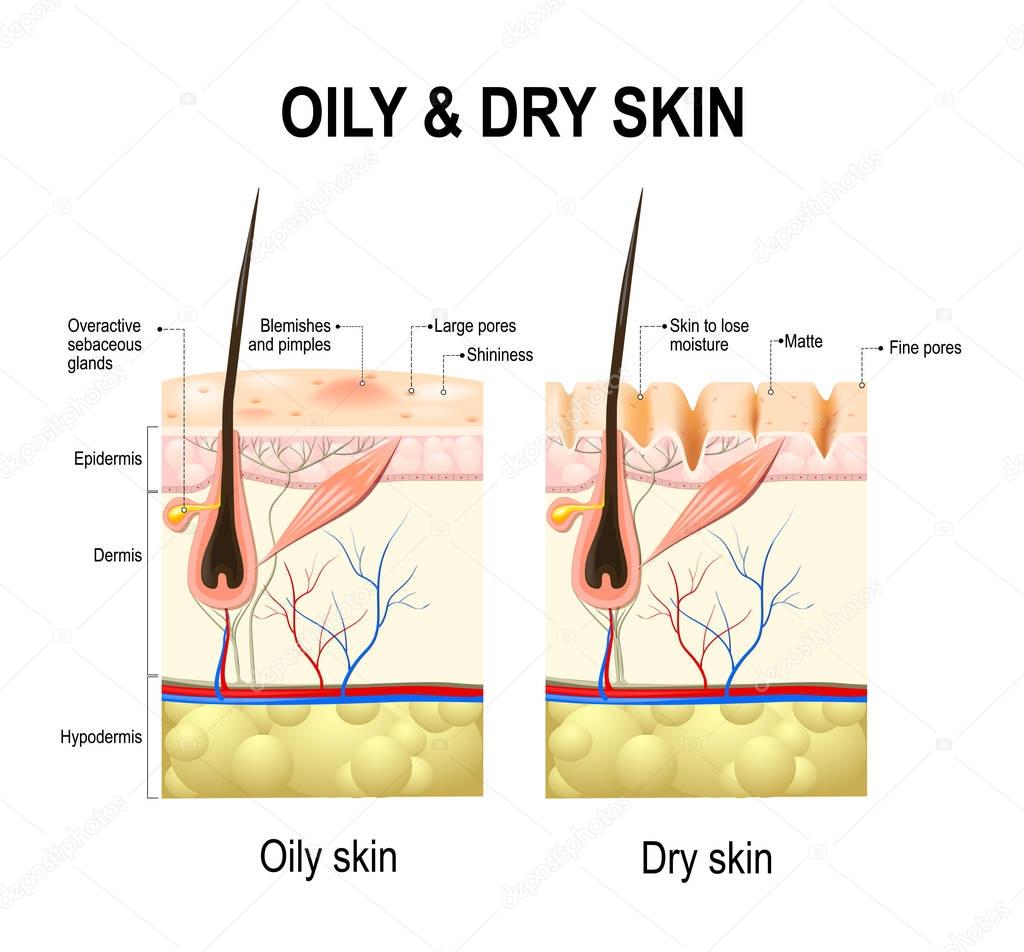 Oily & dry skin. Human Skin types and conditions. 