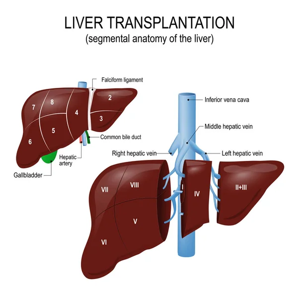 Trasplante de hígado. anatomía segmentaria del hígado — Archivo Imágenes Vectoriales