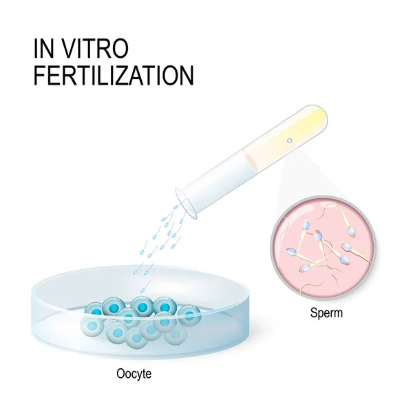 Az in vitro megtermékenyítés. mesterséges megtermékenyítés — Stock Vector