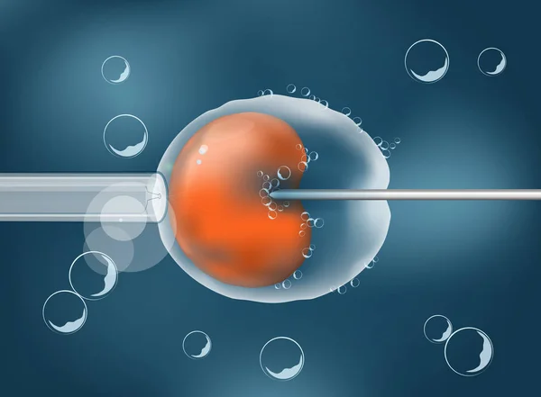 Az in vitro megtermékenyítés. IVF. Ábra könnyen szerkeszthető, az a — Stock Vector