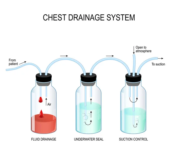 Système de drainage thoracique — Image vectorielle