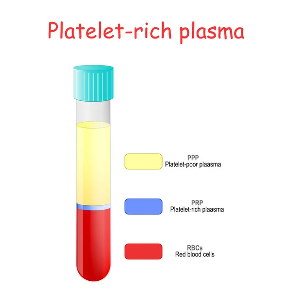 Plasma rico en plaquetas. capas de sangre en el tubo de ensayo . — Vector de stock
