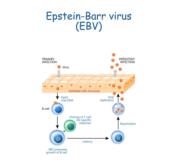 Herpes. De replicatiecyclus van het Epstein-Barr-virus (Ebv) — Stockvector