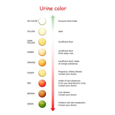 İdrar rengi. Sıvı kaybı ve dehidratasyon grafiği