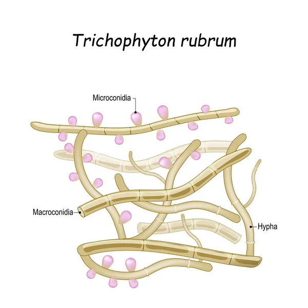 Trichophyton rubrum. Närbild av svampar med fruktbar hyf — Stock vektor