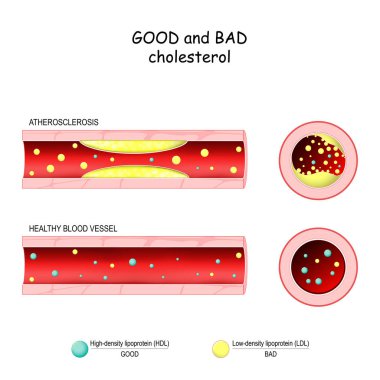 good (HDL) and bad (LDL) cholesterol. Healthy blood vessel and A clipart