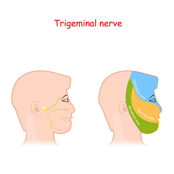 神経の三叉神経や神経の主要部分です 頭部神経学的計画 上顎および顎の枝を持つ男性の頭 顔神経回路網と痛み領域を持つベクトル図 — ストックベクタ