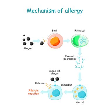 Mechanism of allergy. Mast cells and allergic reaction. B-cell is exposed to allergen, plasma cells will initiate an overproduction of IgE antibodies. The IgE molecules attach themselves to mast cells. When allergen enters the body for the second tim clipart