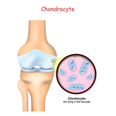 knee and close up of cells of a cartilage. chondrocytes are lying in the lacunae and produce and maintain the cartilaginous matrix, and collagen. clipart