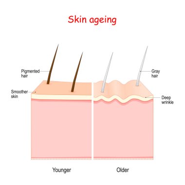 Yaşlanma süreci. Pigmentli saçlı daha genç tenden daha yaşlı cilde ve kırışık ve gri saçlara.