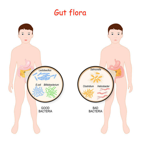 Хорошие и плохие бактерии. Кишечная флора детей. Дети с кишечником и различными формами бактерий. Крупный план энтериальных бактерий. Кишечная флора с пробиотиком. Векторная иллюстрация для медицинского и образовательного использования

