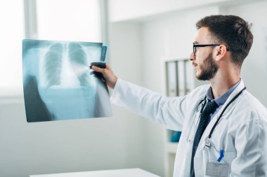 Doktor ofisinde röntgene bakıyor.