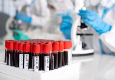 PPE giysisi ve yüz maskesi olan bilim insanları ve mikrobiyologlar Coronavirus aşısı üretmek için kovid19 numaralı hastalardan toplanan kanla test tüpünü tutuyorlar. Covid-19, laboratuvar ve aşı konsepti..