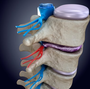 Spinal kord şişkin disk baskısı altında. 3D render