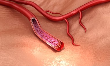 Kan damarı makro eritrositler, tıbben doğru 3d çizim ile dilimlenmiş