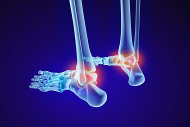 İskelet ayak - injuryd talus kemiği. Xray görünümü. Tıbben doğru 3d çizim 