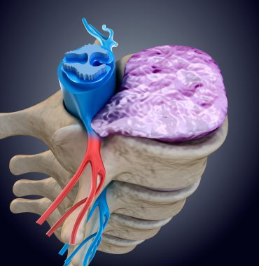 Spinal kord şişkin disk baskısı altında. Tıbben doğru 3d çizim  
