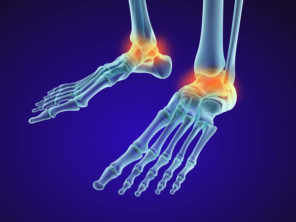 Skelettfuß - verletzte Talusknochen. Röntgenbild. medizinisch korrekte 3D-Illustration — Stockfoto