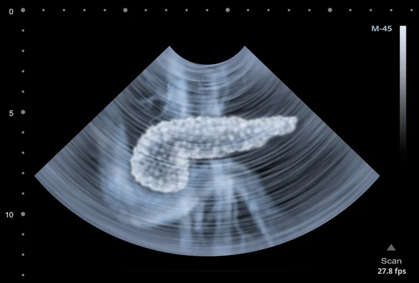Ultraschallbild der menschlichen Bauchspeicheldrüse. Illustration — Stockfoto
