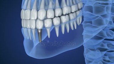 Şeffaf kürek ve diş, xray görünümü. 3D animasyon
