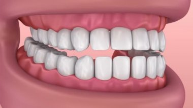 Ağzına sakız ve dişler. Tıbben doğru diş 3d animasyon.