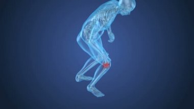 Diz ağrısı saldırı, adam spinal diz acı. 3D animasyon