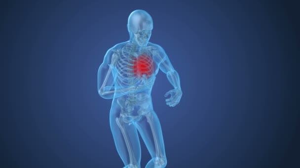 Heart Attack Man Suffering Heart Pain Animation — Stock Video