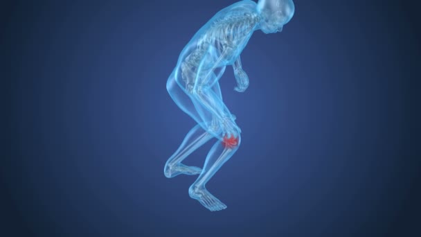 膝の痛み攻撃 脊髄の膝から苦しんでいる人 アニメーション — ストック動画