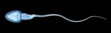 Sperm illüstrasyon, tıbben doğru 3d çizim