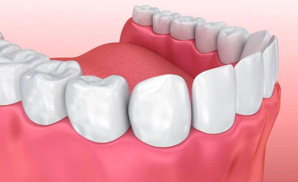 Στόματος Των Ούλων Και Των Δοντιών Ιατρικώς Ακριβή Δόντι Απεικόνιση — Φωτογραφία Αρχείου