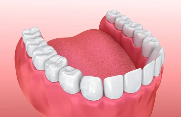 口の中の歯茎と歯 医学的に正確な歯の — ストック写真