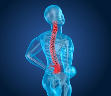 Saldırı, adam spinal ağrı acı spinal ağrı. 3D çizim
