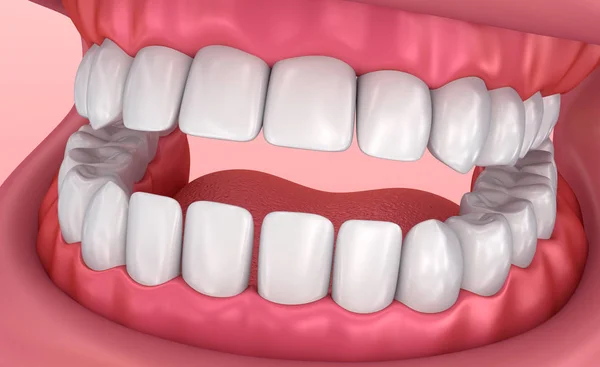 Gomme Masticare Denti Illustrazione Del Dente Clinicamente Accurata — Foto Stock