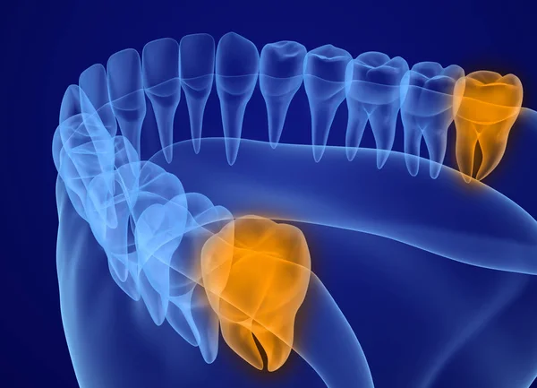 Vista Raggi Dei Denti Sapienti Illustrazione Del Dente Clinicamente Accurata — Foto Stock