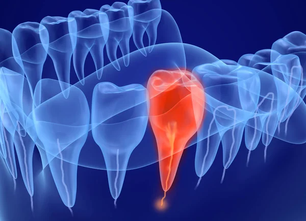 Problemi Vista Dei Denti Raggi Illustrazione Del Dente Clinicamente Accurata — Foto Stock