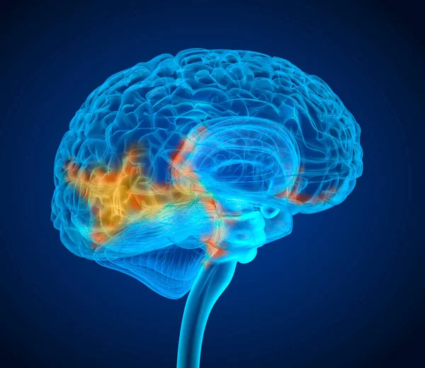 Exploración Rayos Del Tumor Cerebral Humano Ilustración Médicamente Precisa —  Fotos de Stock
