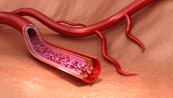 Blodkärl Som Skivad Makro Med Erytrocyter Medicinskt Korrekt Illustration — Stockfoto