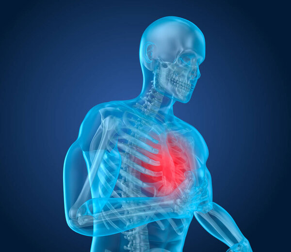 Heart Attack, man suffering from heart pain. 3D illustration