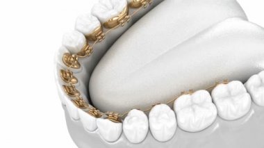 Dil telleri sistemi. Altın diş tellerinin 3D animasyon konsepti