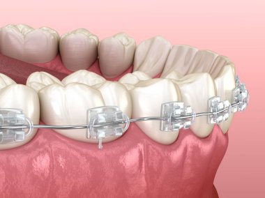 Alt çene ve temiz diş telleri. Tıbbi olarak doğru olan 3 boyutlu diş illüstrasyonu
