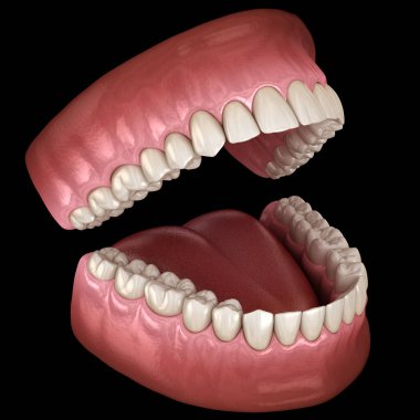 Diş anatomisi - Açık Protezler. Tıbbi olarak doğru diş 3d illüstrasyon