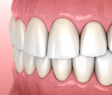 Sağlıklı insan sakızı ve diş anatomisi. Tıbbi olarak doğru diş 3D illüstrasyon