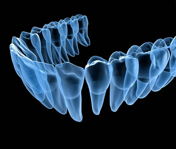 Anatomia Dentale Delle Gengive Dei Denti Umani Mandibolari Vista Raggi — Foto Stock