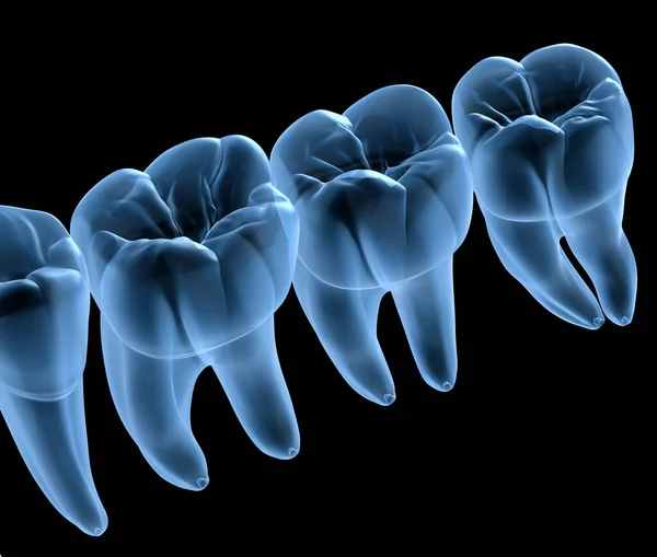 Anatomia Dentale Delle Gengive Dei Denti Umani Mandibolari Vista Raggi — Foto Stock